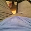 Fistners1