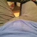 Fistners1