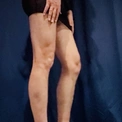 Driada