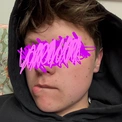 twinkky