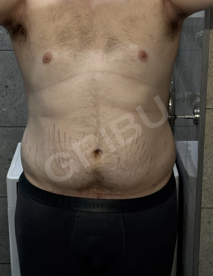 Advertisement (8526507) - Peter2023 2