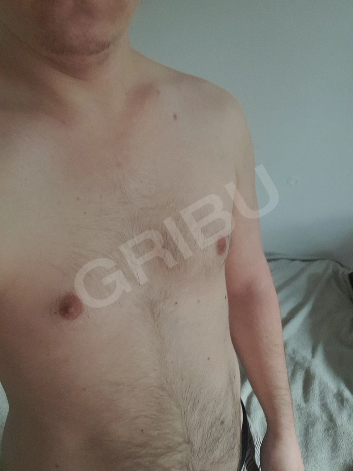 Advertisement (8552987) - Nikita144 1