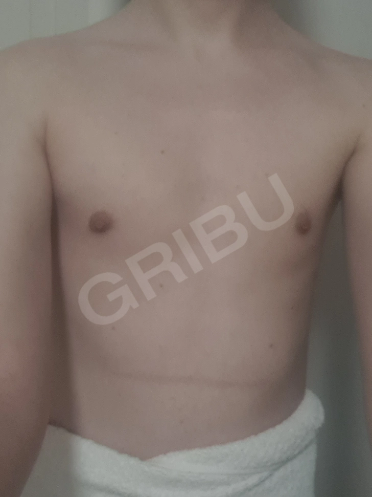 Sludinājumu (8791445) - Gribusexs 1