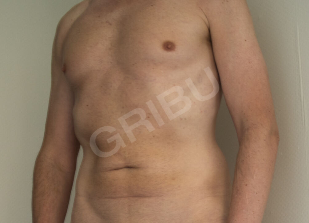 Advertisement (8828555) - garais13 1