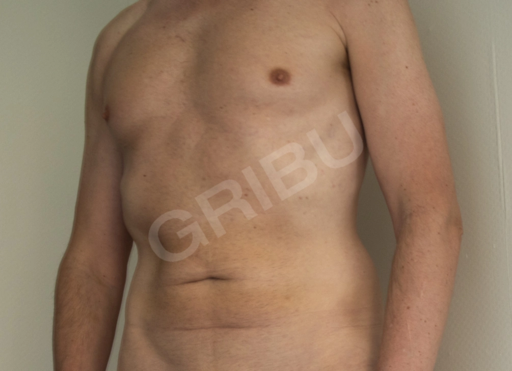 Advertisement (8828127) - garais13 1