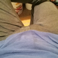 Fistners1