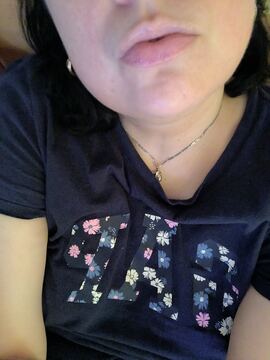 NERA