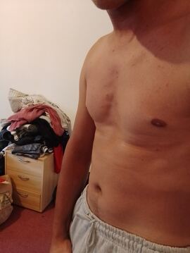 Leo18+